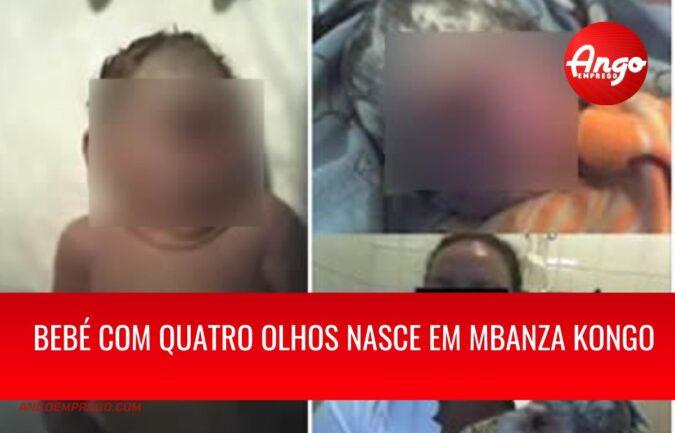 Bebé com quatro olhos nasce em Angola